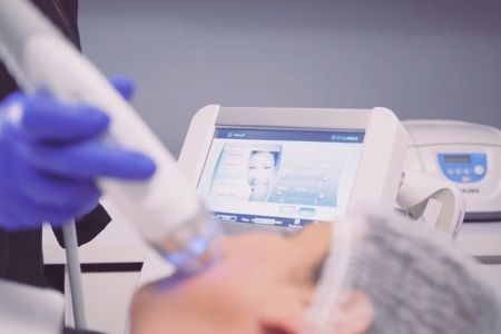 3 tratamientos faciales para lucir un rostro radiante en estas fiestas