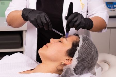 Suaviza, minimiza y previene líneas de expresión a través del bloqueo temporal de los músculos del tercio superior del rostro, consiguiendo un resultado natural y casi inmediato.