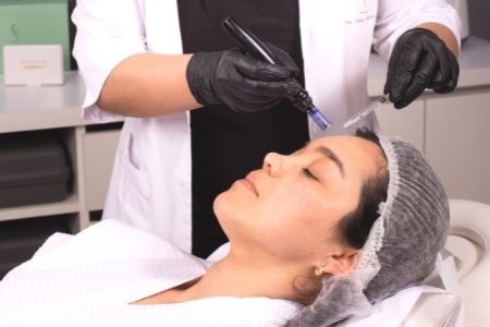 Mesoterapia facial con vitaminas: revitaliza tu piel