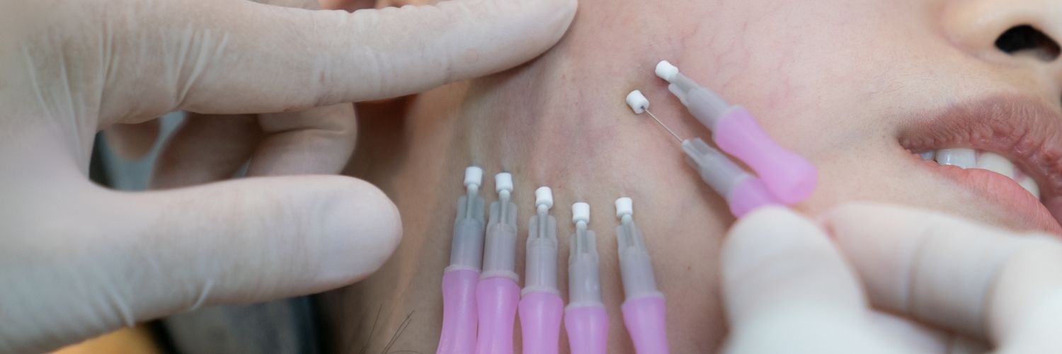 Recupera la forma de tu rostro con Hilos Tensores