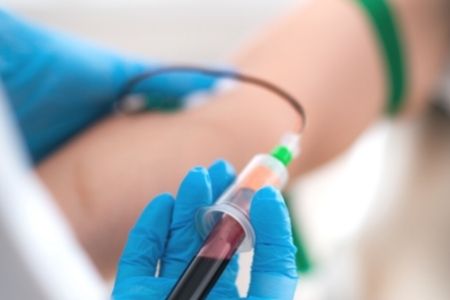 Plasma Rico en Plaquetas Conoce sus beneficios Clínica estética LB Medical Spa